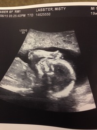Milo's First Photos