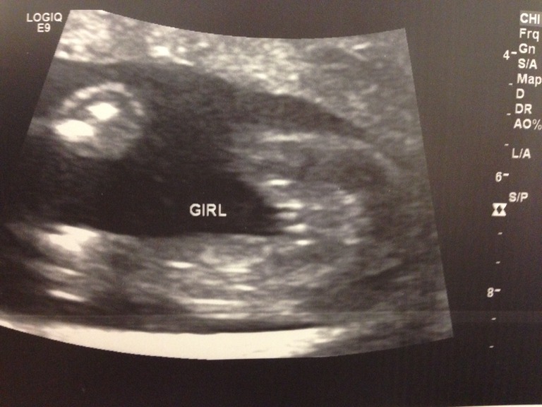 Milo's First Photos